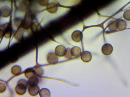 Attēlu rezultāti vaicājumam “Stemonaria irregularis spores”