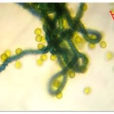 Attēlu rezultāti vaicājumam “Hemitrichia serpula spores”