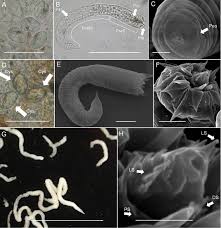 Attēlu rezultāti vaicājumam “Nematomorpha”