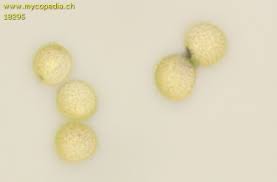 Attēlu rezultāti vaicājumam “Hemitrichia calyculata spores”