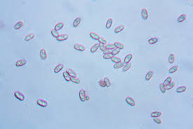 Attēlu rezultāti vaicājumam “Rhizopogon luteolus”