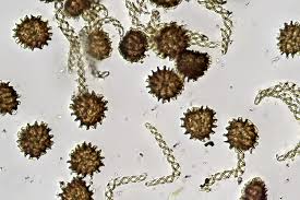 Attēlu rezultāti vaicājumam “Fossombronia wondraczekii”