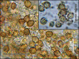 Attēlu rezultāti vaicājumam “Chaenotheca chlorella”