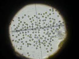 Attēlu rezultāti vaicājumam “Lichenoconium xanthoriae”