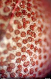 Attēlu rezultāti vaicājumam “Lycogala fuscoolearium macro”