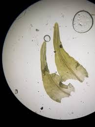 Attēlu rezultāti vaicājumam “Anomodon viticulosus sporophyte”