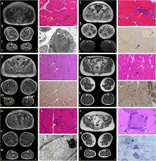 Image result for  f g   C g  p  