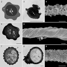 Attēlu rezultāti vaicājumam “Hemitrichia leiotricha stalked”