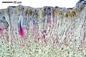 Attēlu rezultāti vaicājumam “Lecanora allophana”