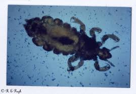 Attēlu rezultāti vaicājumam “Pediculus humanus capitis”