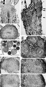 Attēlu rezultāti vaicājumam “Acaulon muticum sporophyte”