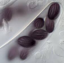 Attēlu rezultāti vaicājumam “Ascobolus furfuraceus”