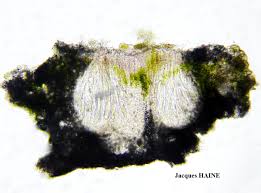 Attēlu rezultāti vaicājumam “Pertusaria pertusa”