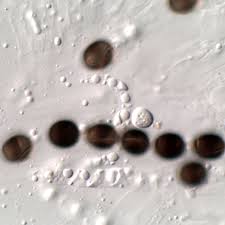 Attēlu rezultāti vaicājumam “Biscogniauxia marginata”