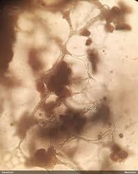 Attēlu rezultāti vaicājumam “Physarum sulphureum stalked”