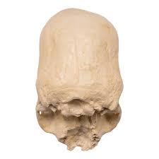 Image result for elongated skulls