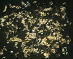 Attēlu rezultāti vaicājumam “Stemonaria irregularis spores”