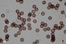 Attēlu rezultāti vaicājumam “Badhamiopsis ainoae macro”