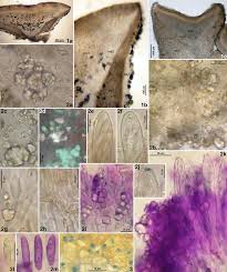 Attēlu rezultāti vaicājumam “Ombrophila violacea spores”
