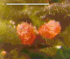 Attēlu rezultāti vaicājumam “Octosporella jungermanniarum”