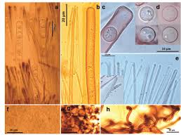 Attēlu rezultāti vaicājumam “Pseudoplectania nigrella”