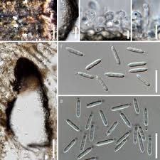 Attēlu rezultāti vaicājumam “Diderma floriforme macro”