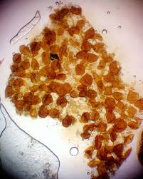 Attēlu rezultāti vaicājumam “Lycogala fuscoolearium”