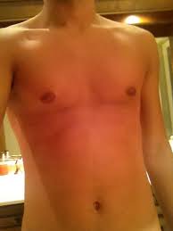 Image result for manboobs