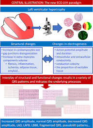 Image result for  ^ L V [ h    