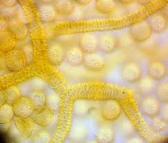 Attēlu rezultāti vaicājumam “Heterotrichia ferruginea (syn. Arcyria ferruginea) macro”