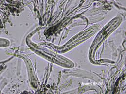 Attēlu rezultāti vaicājumam “Opegrapha rufescens”
