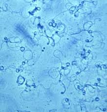 Attēlu rezultāti vaicājumam “Marchantiopsida”