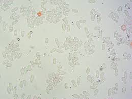 Attēlu rezultāti vaicājumam “Ceratiomyxa porioides spores”