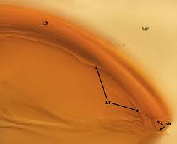Attēlu rezultāti vaicājumam “Diderma globosum spores”