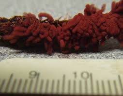 Attēlu rezultāti vaicājumam “Arcyria denudata spores”