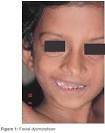 Indian Journal of Dermatology, Venereology and Leprology (IJDVL