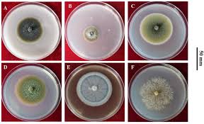 Attēlu rezultāti vaicājumam “Diderma subviridifuscum var. macrospora* spores”