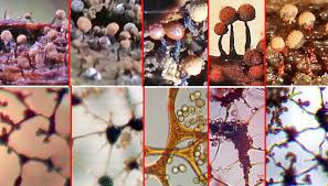 Attēlu rezultāti vaicājumam “Comatricha meandrispora macro”