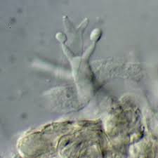 Attēlu rezultāti vaicājumam “Exobasidium vaccinii”