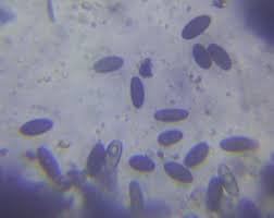 Attēlu rezultāti vaicājumam “Biscogniauxia granmoi”