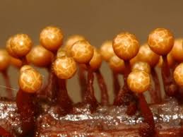 Attēlu rezultāti vaicājumam “Trichia erecta spores”