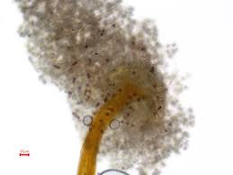 Attēlu rezultāti vaicājumam “Didymium xanthopus spores”