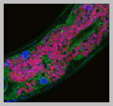 Attēlu rezultāti vaicājumam “Comatricha elegans var. microspora macro”