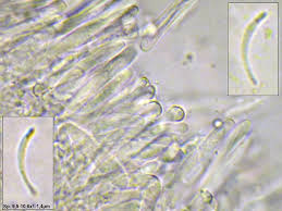 Attēlu rezultāti vaicājumam “Orbilia sp.”