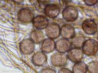 Attēlu rezultāti vaicājumam “Colloderma oculatum spores”