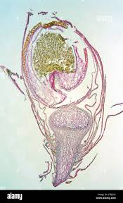 Attēlu rezultāti vaicājumam “Sphagnum squarrosum sporophyte”