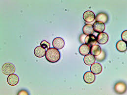 Attēlu rezultāti vaicājumam “Stemonitopsis subcaespitosa”