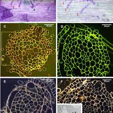 Attēlu rezultāti vaicājumam “Leskea polycarpa sporophyte”