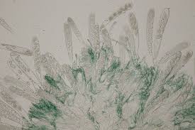 Attēlu rezultāti vaicājumam “Octosporella jungermanniarum”