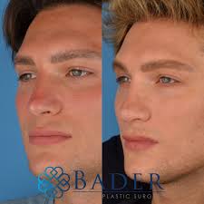 Attēlu rezultāti vaicājumam “Diderma testaceum young”